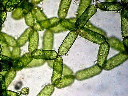 Колонии одноклеточных водорослей под микроскопом